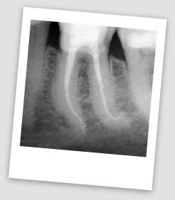 endodonzia