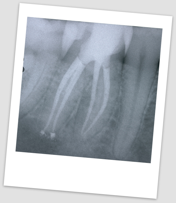 Endodonzia